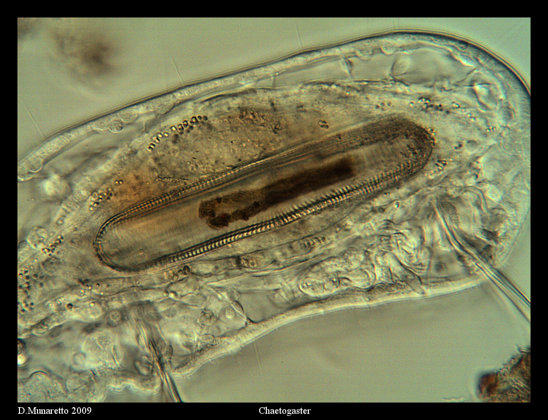 Chaetogaster...con Diatomea Gigante